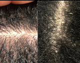 Scalp Solution Detox Tonic (itchy scalp)