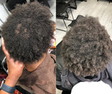 Hairloss. Oil for Men