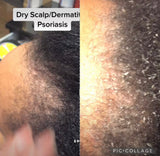 Deseed Scalp
