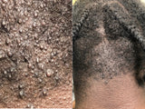 Scalp Solution Detox Tonic (itchy scalp)