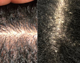 Hair-loss Shampoo