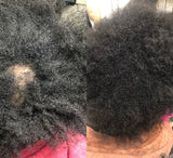 Inflamed Scalp Drops