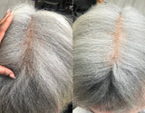 Hairloss/Alopecia Complete Bundle shampoo + Treatment + Leave-in + Extreme 22 Serum